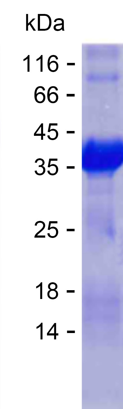 Recombinant Human CSDE1 Protein(C-His)