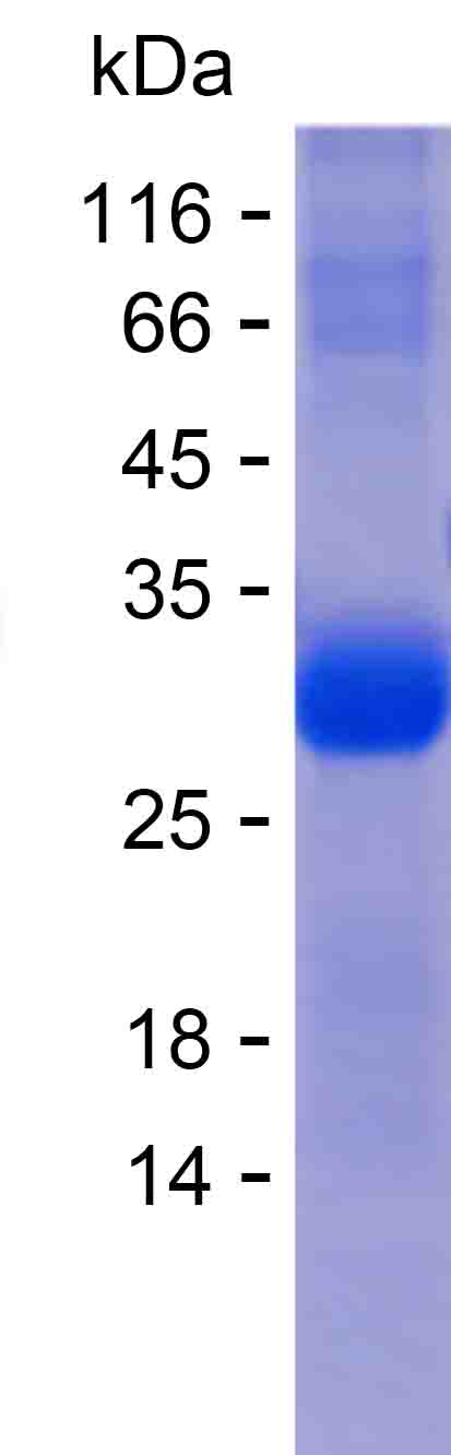 Recombinant Human ADH1A Protein(C-His)