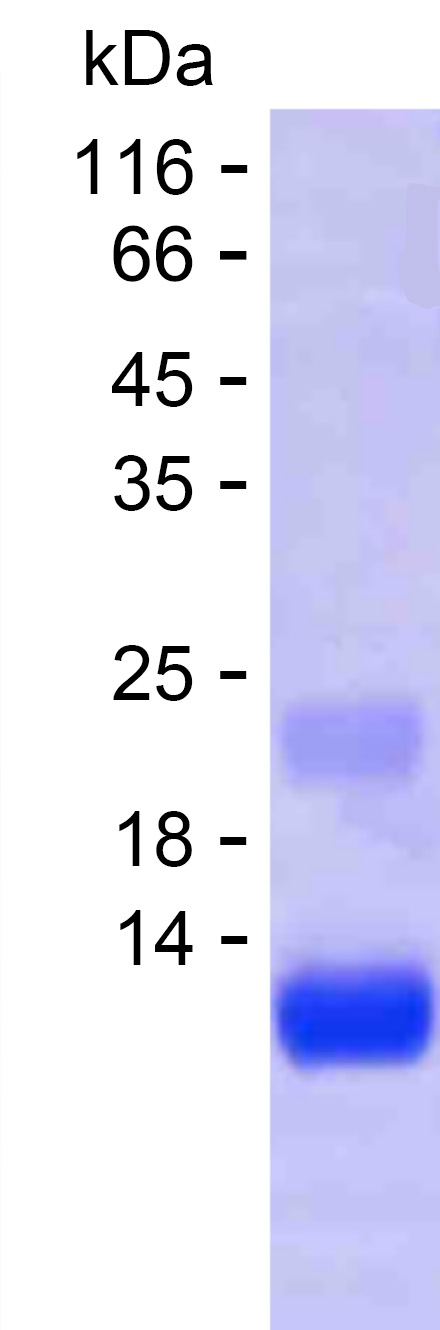 Recombinant Human PABPN1 Protein(C-His)