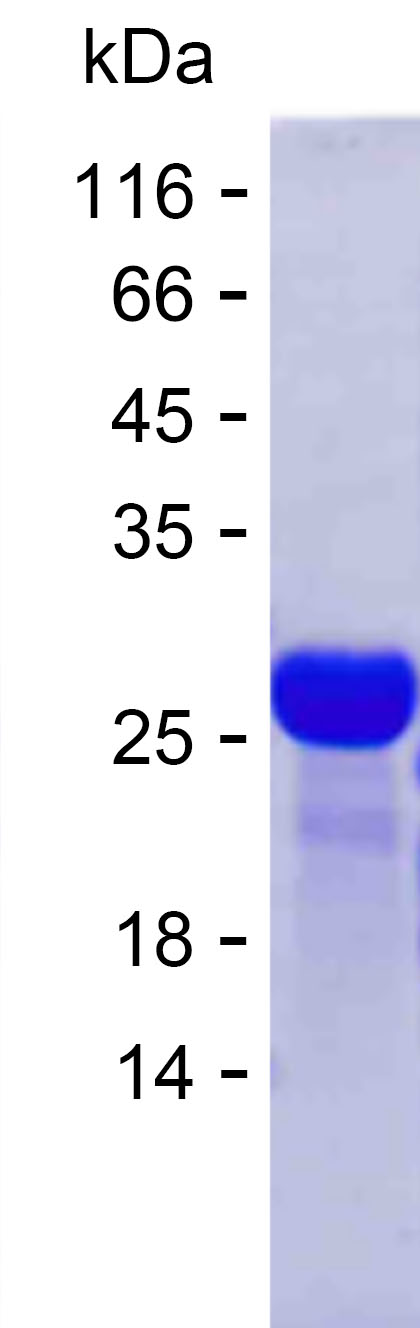 Recombinant Human CACNA1A Protein(C-His)