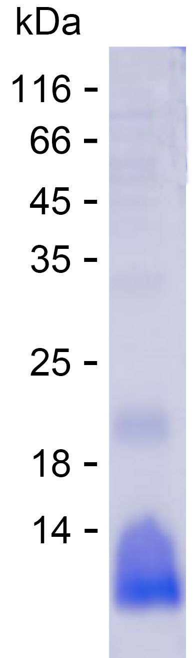 Recombinant Human VAMP5 Protein(C-His)