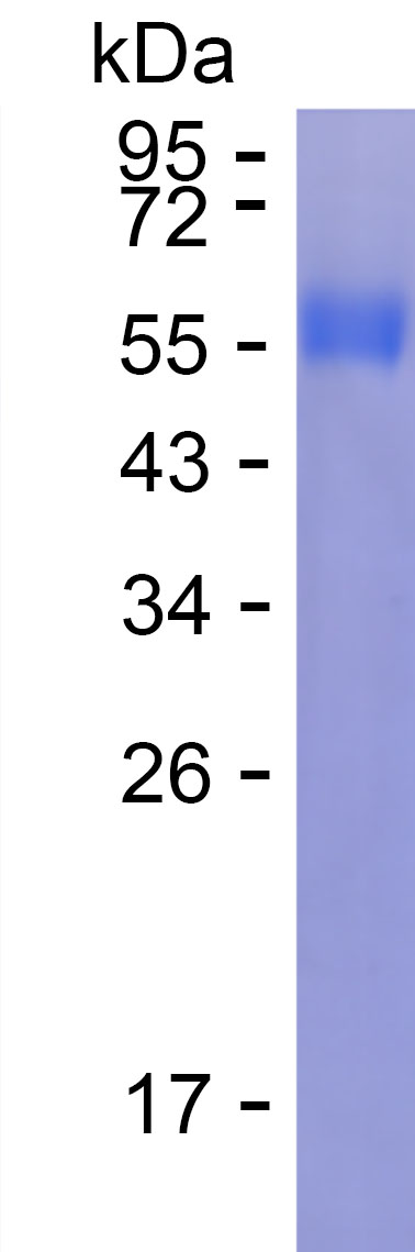 Recombinant Human ENPP7 Protein(C-His)