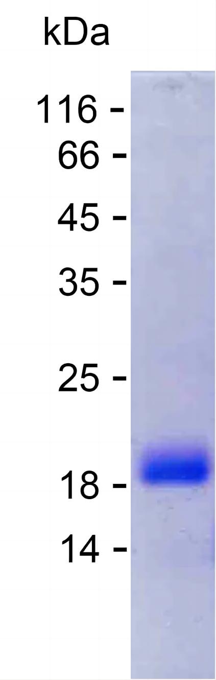 Recombinant Human PXN Protein(C-His)