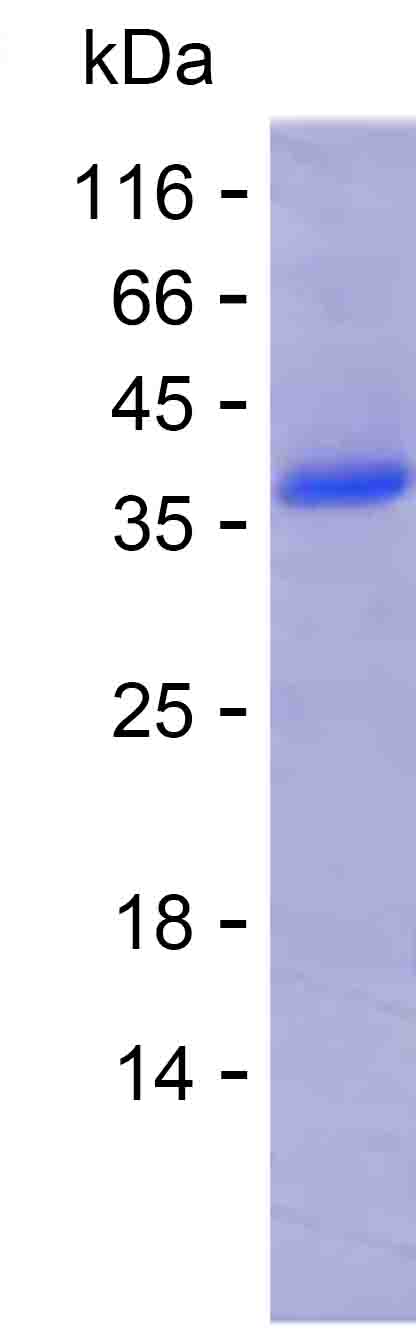 Recombinant Human DCTN4 Protein(C-His)