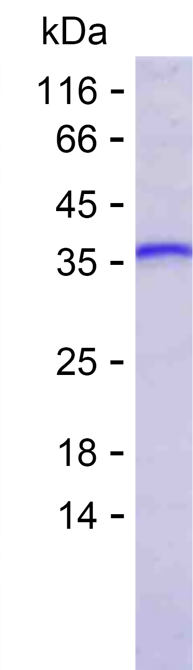 Recombinant Human H1-5 Protein(C-His)