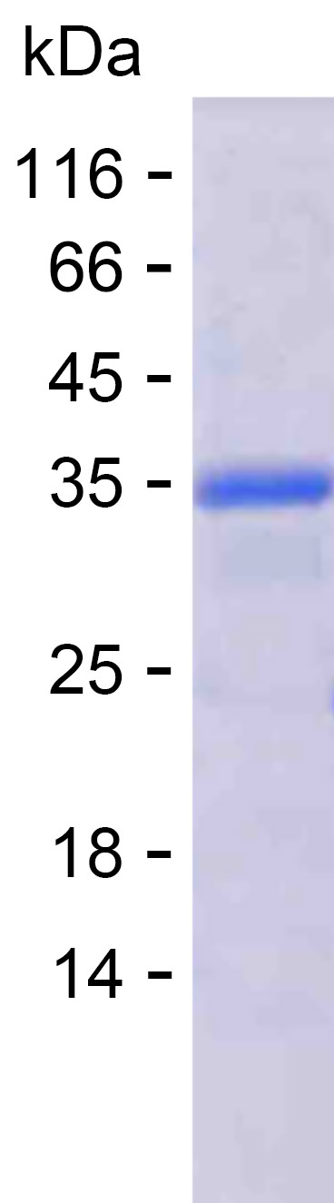 Recombinant Human CASP9 Protein(N-His)