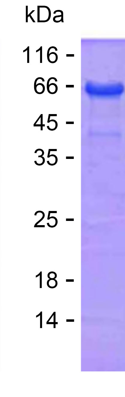 Recombinant Human ATE1 Protein(C-His)