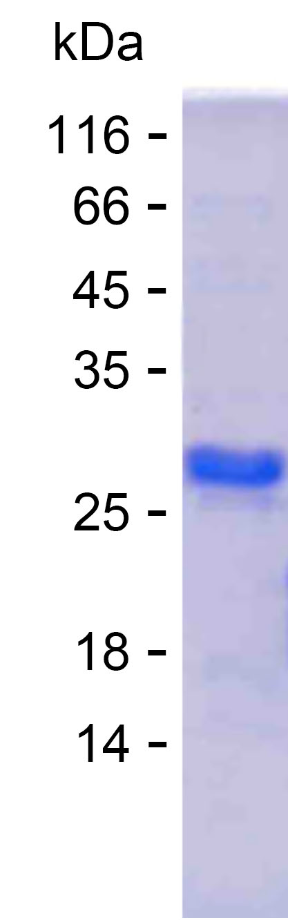 Recombinant Human RNF150 Protein(C-His)