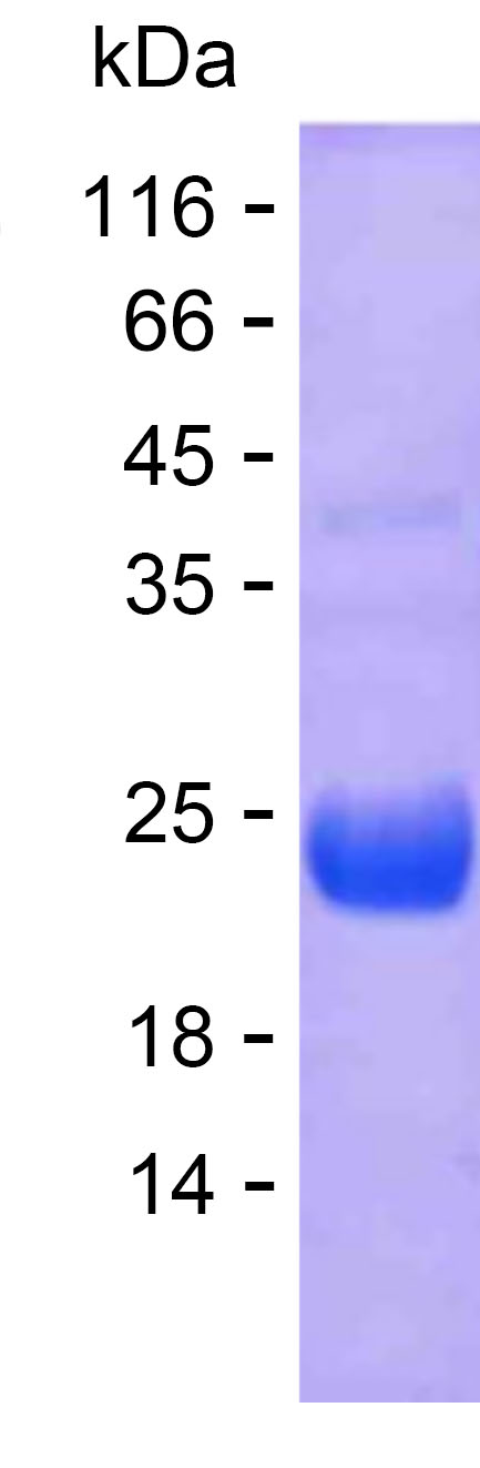 Recombinant Human RAC1 Protein(C-His)