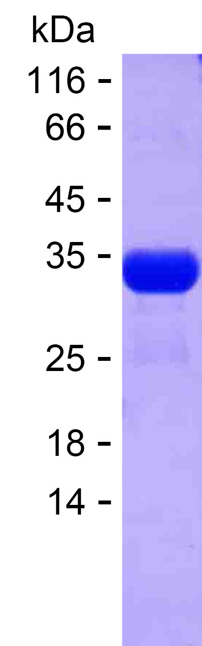 Recombinant Human GOLGA6L9 Protein(C-His)