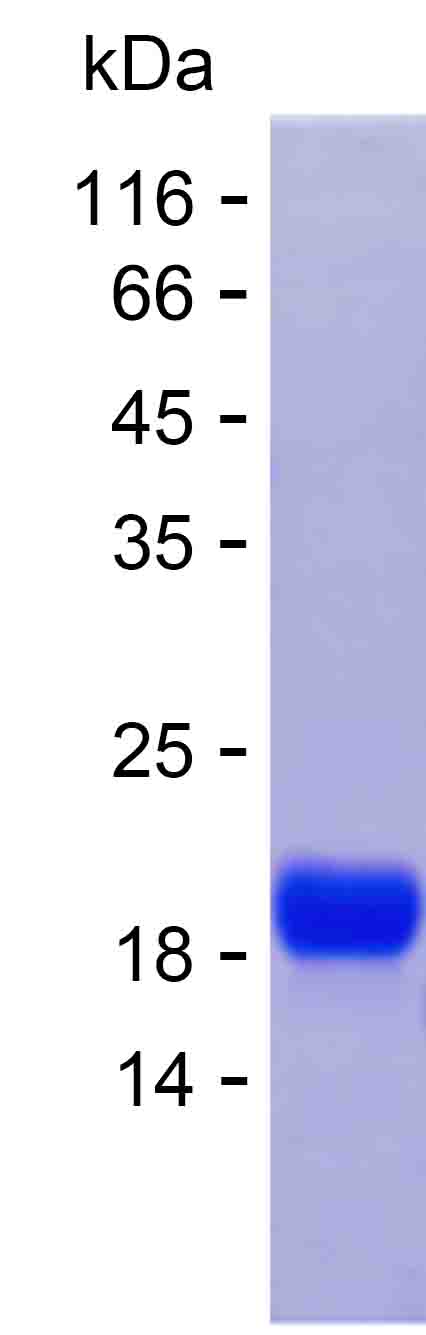 Recombinant Human PDCD5 Protein(C-His)