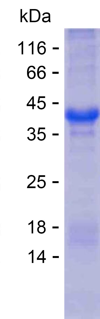 Recombinant Human BSND Protein(C-His)