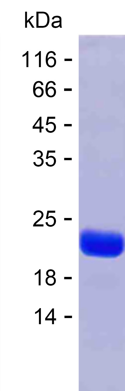 Recombinant Human FAIM Protein(C-His)