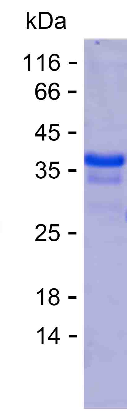 Recombinant Human PML Protein(C-His)