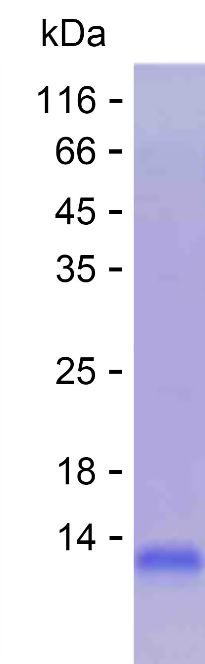 Recombinant Human ATP6V0A4 Protein(C-His)