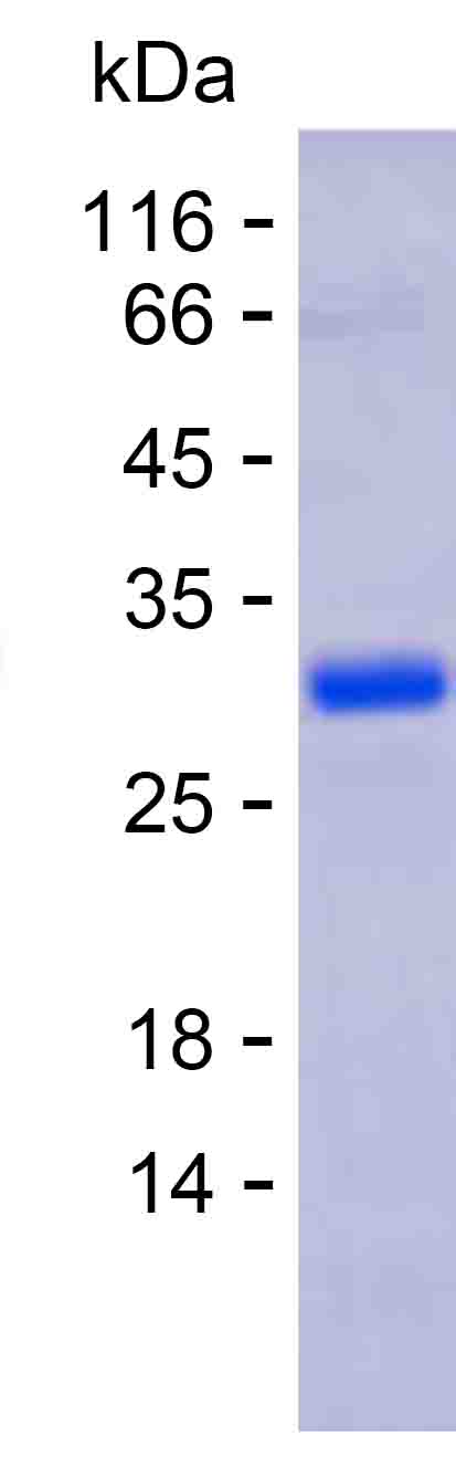 Recombinant Human PDE6C Protein(C-His)