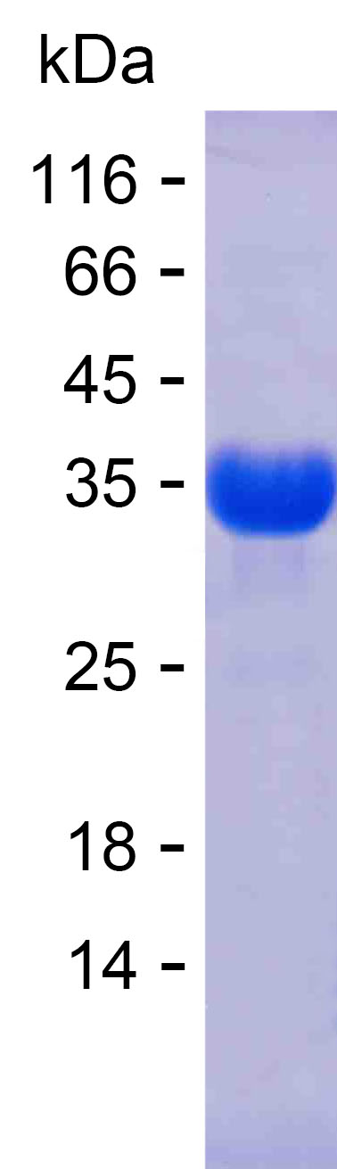 Recombinant Human TFAP2A Protein(C-His)