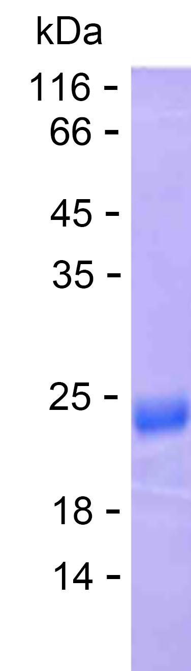 Recombinant Human ZFYVE26 Protein(C-His)