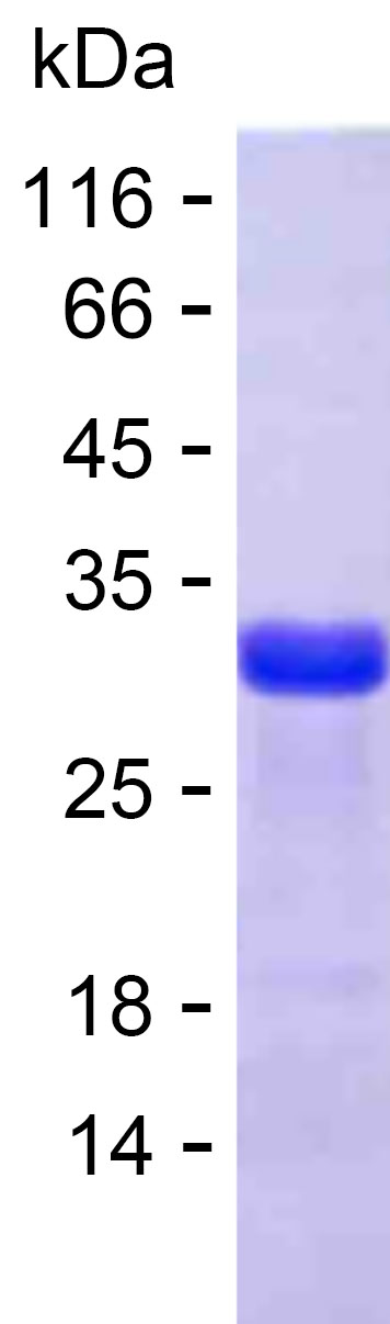 Recombinant Human ERVK-6 Protein(C-His)