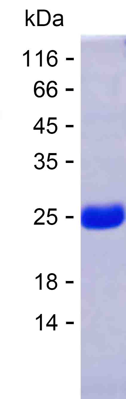 Recombinant Human CZIB Protein(C-His)