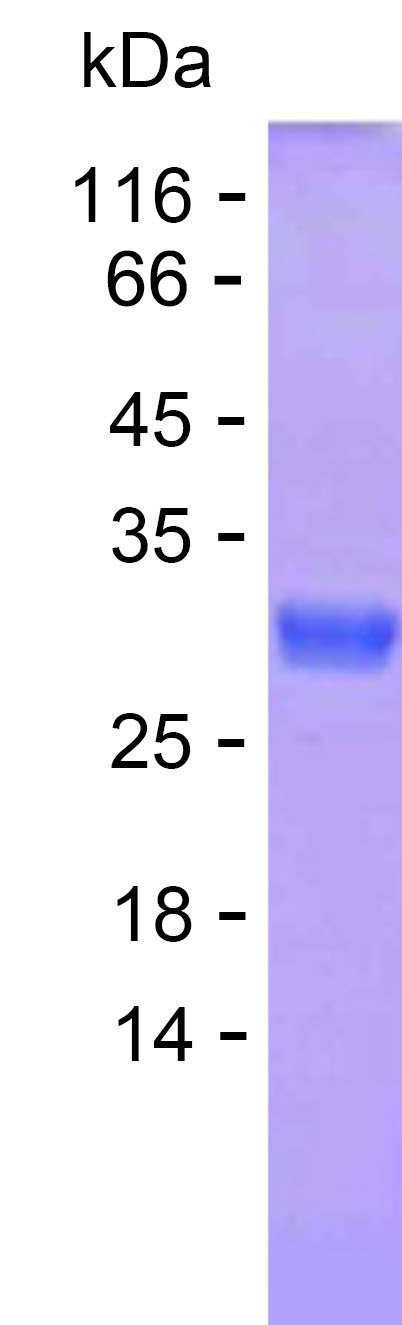 Recombinant Human LIX1L Protein(C-His)