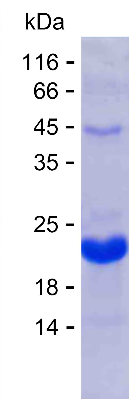 Recombinant Human DEFB110 Protein(N-SUMO & C-His)