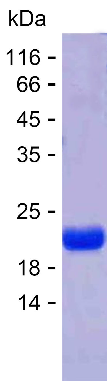 Recombinant Human STEAP4 Protein(C-His)