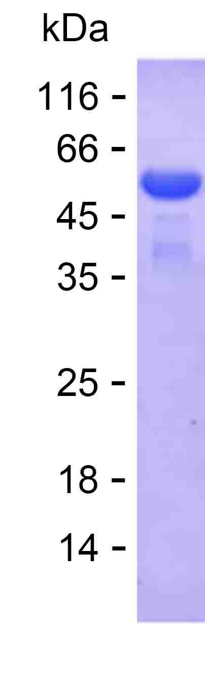 Recombinant Human NAP1L4 Protein(C-His)