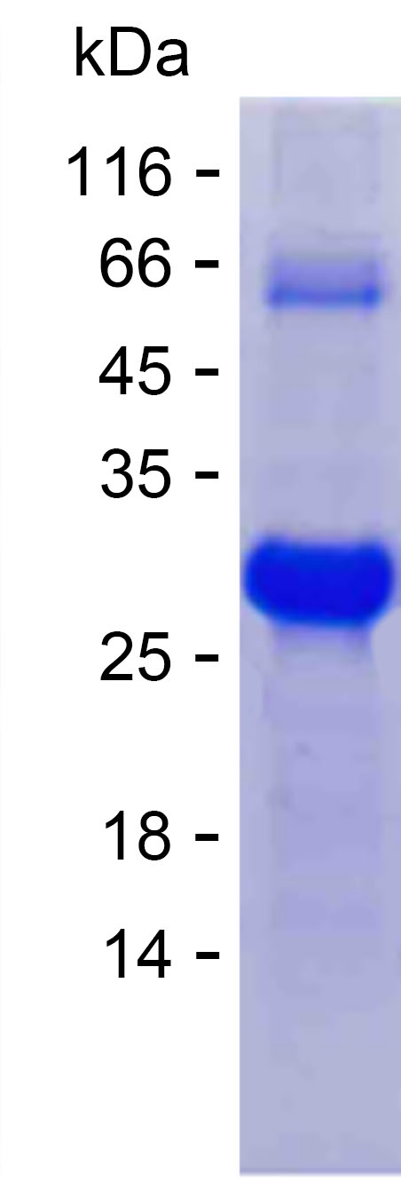 Recombinant Human POLR3K Protein(N-SUMO & C-His)