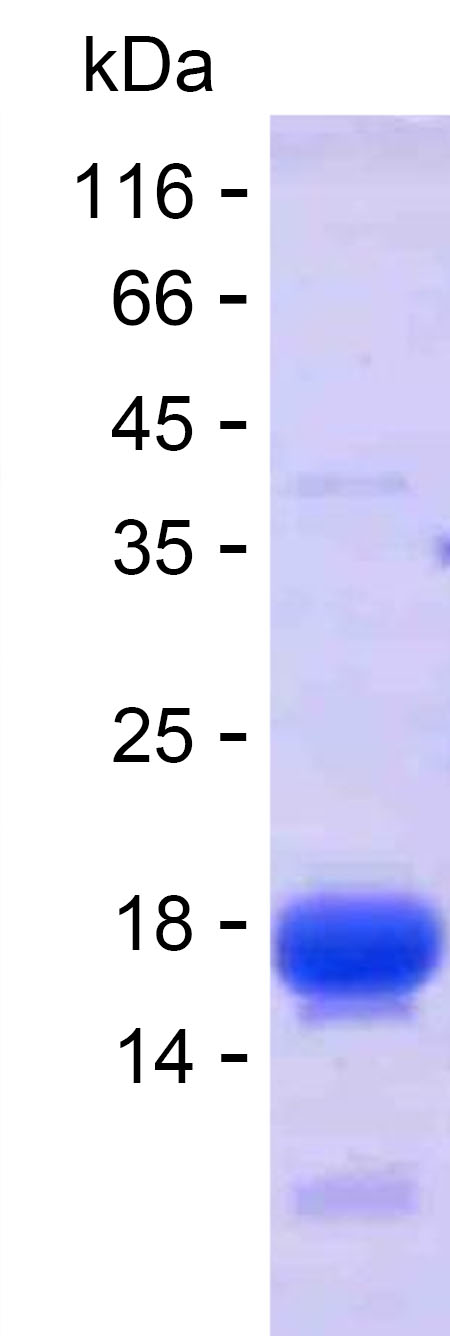 Recombinant Human MYH7 Protein(C-His)
