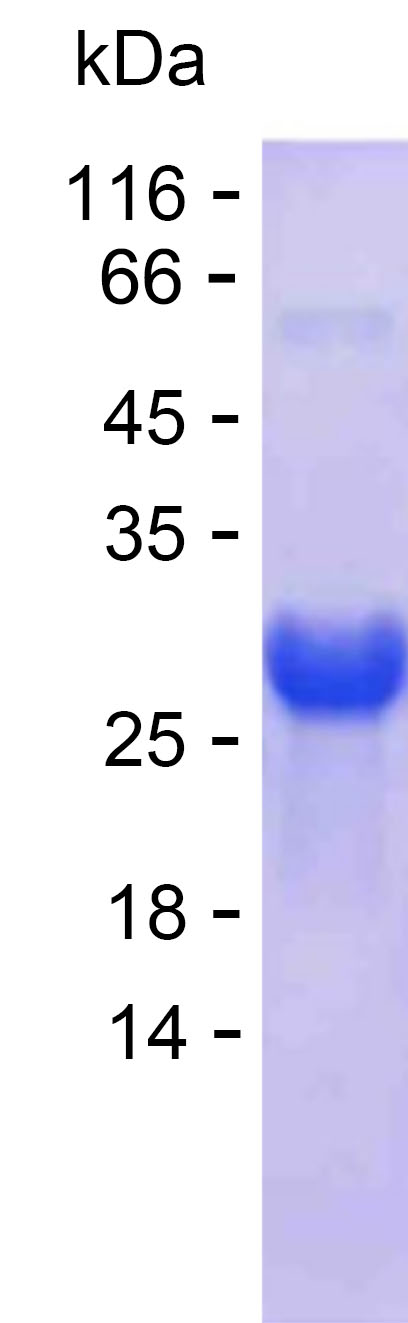 Recombinant Human PHLDB2 Protein(C-His)