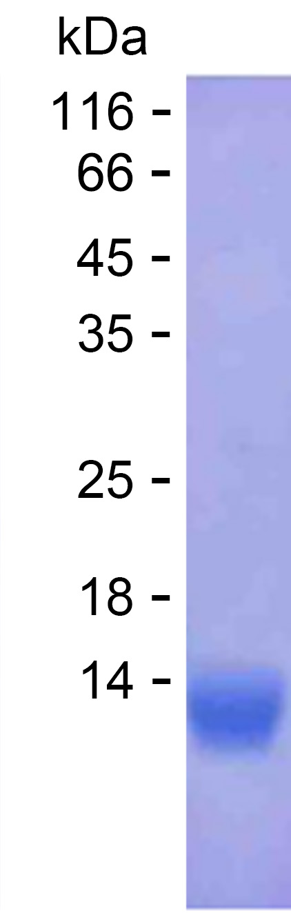 Recombinant Human TTC5 Protein(C-His)