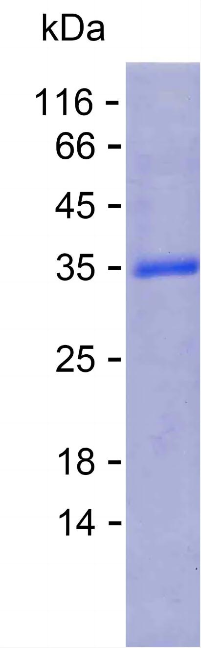 Recombinant Human CPPED1 Protein(C-His)