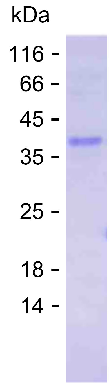 Recombinant Human LMX1B Protein(C-His)
