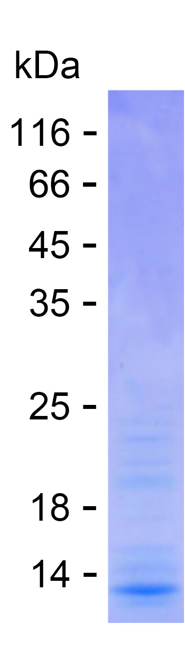 Recombinant Human LSM2 Protein(C-His)