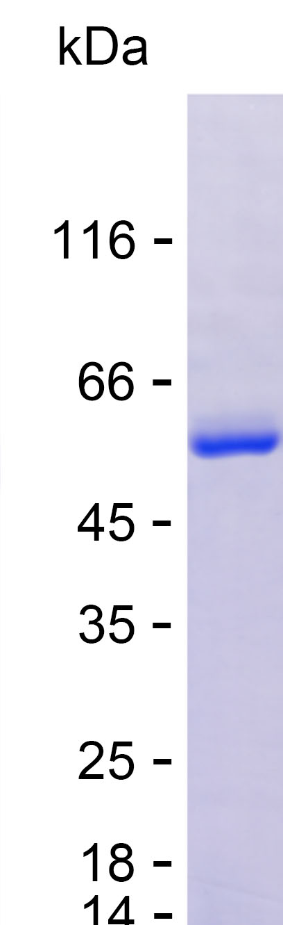 Recombinant Human ADH5 Protein(N-MBP & C-His)