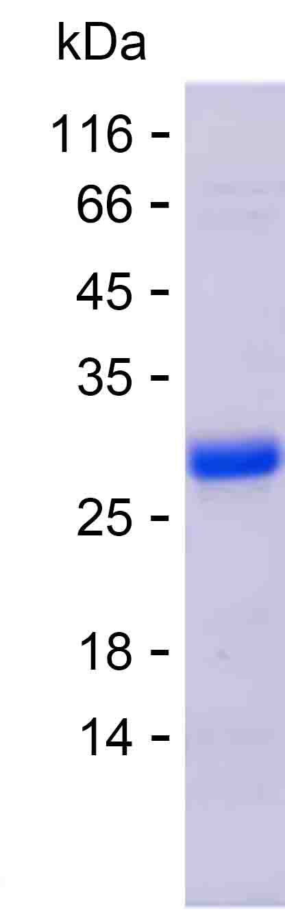 Recombinant Human CYTIP Protein(C-His)