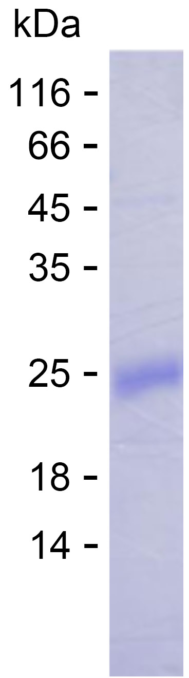 Recombinant Human WDSUB1 Protein(C-His)