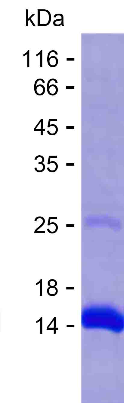 Recombinant Human ZNF487 Protein(C-His)