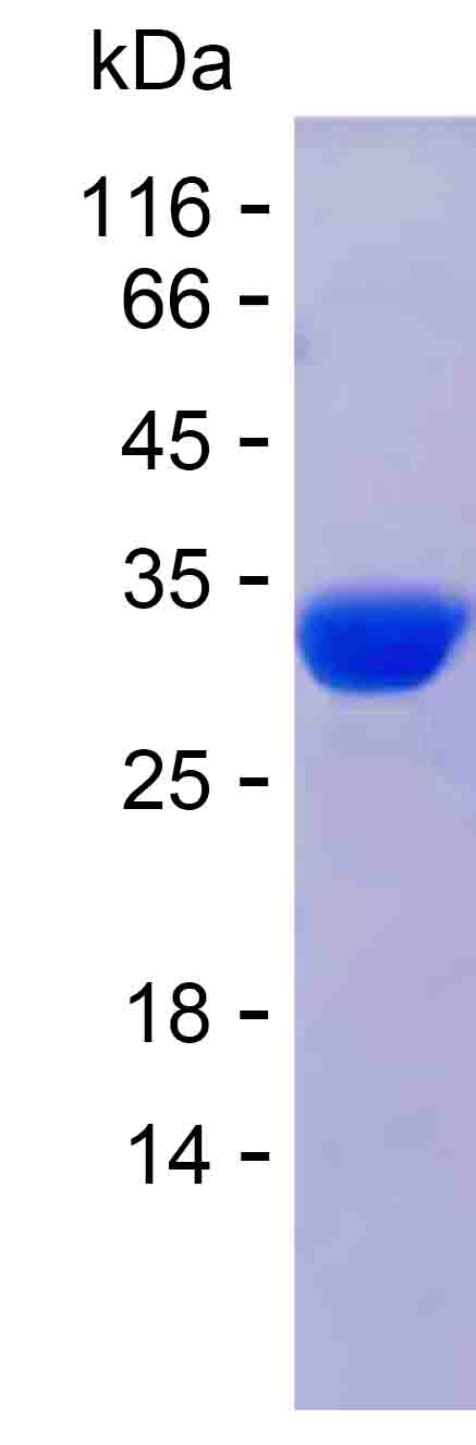Recombinant Human GSTO1 Protein(C-His)