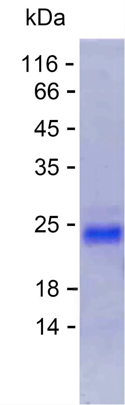 Recombinant Human GVQW3 Protein(C-His)