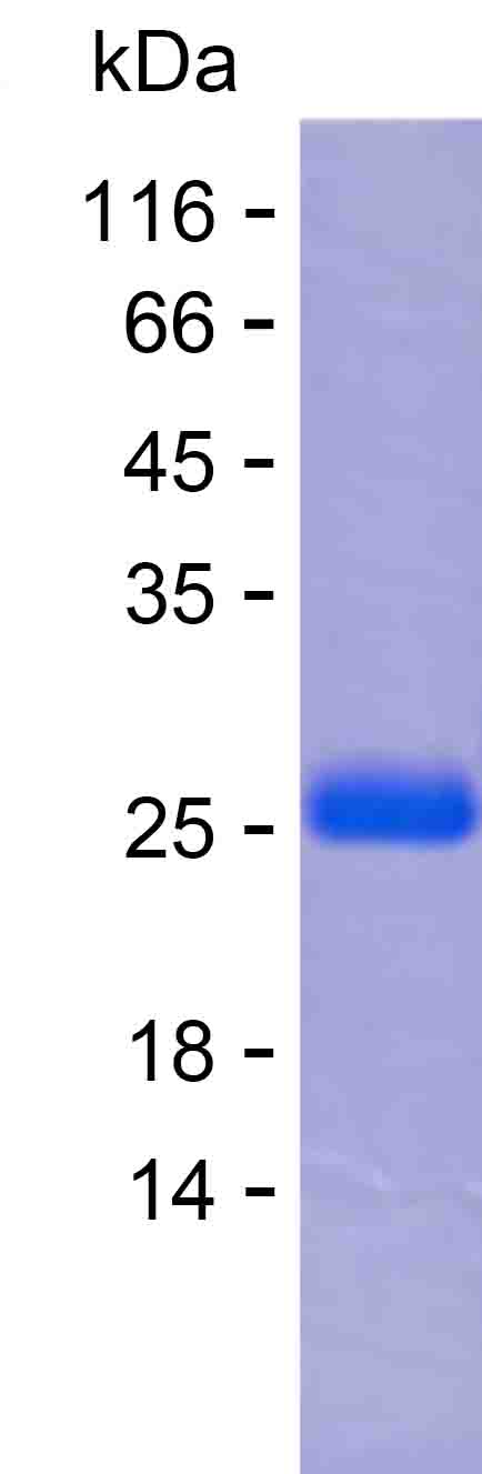 Recombinant Human EXOC7 Protein(C-His)