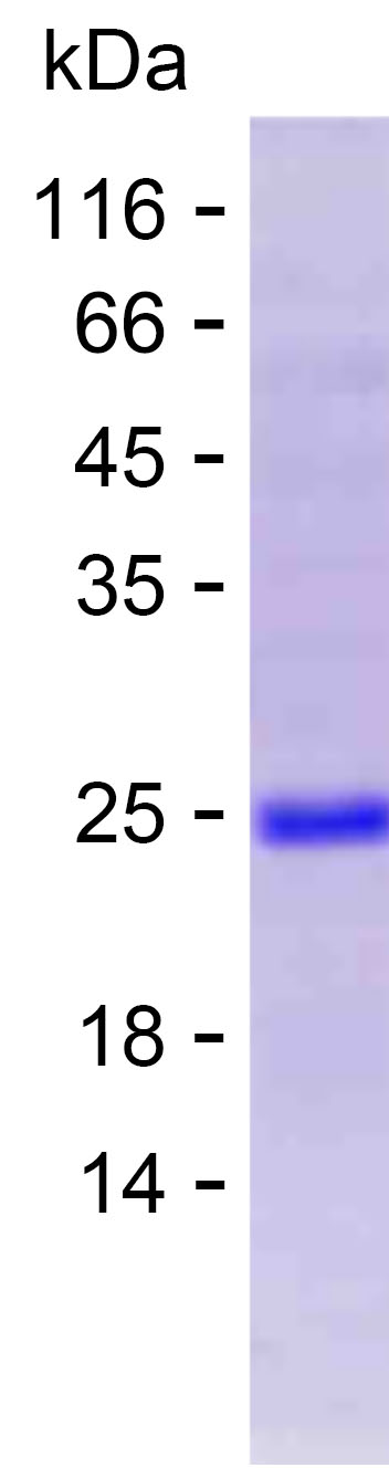 Recombinant Human KCNJ14 Protein(C-His)