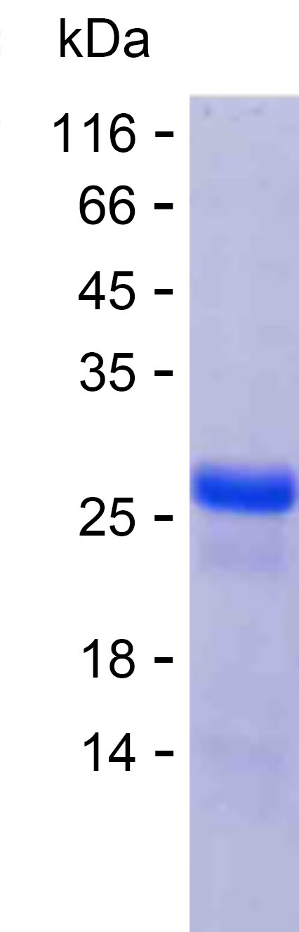 Recombinant Human SYNDIG1 Protein(C-His)