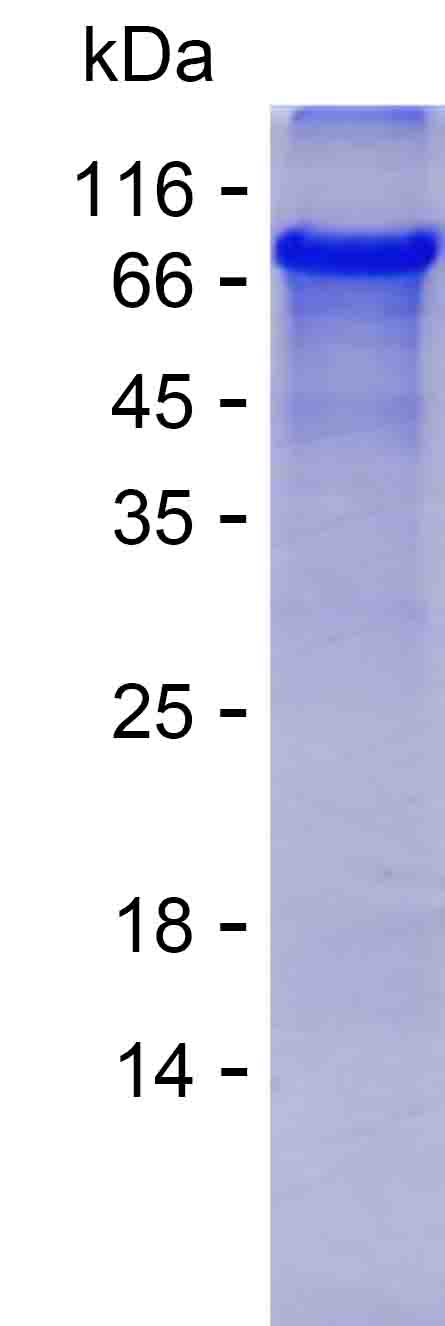 Recombinant Human GUSB Protein(N-SUMO & C-His)