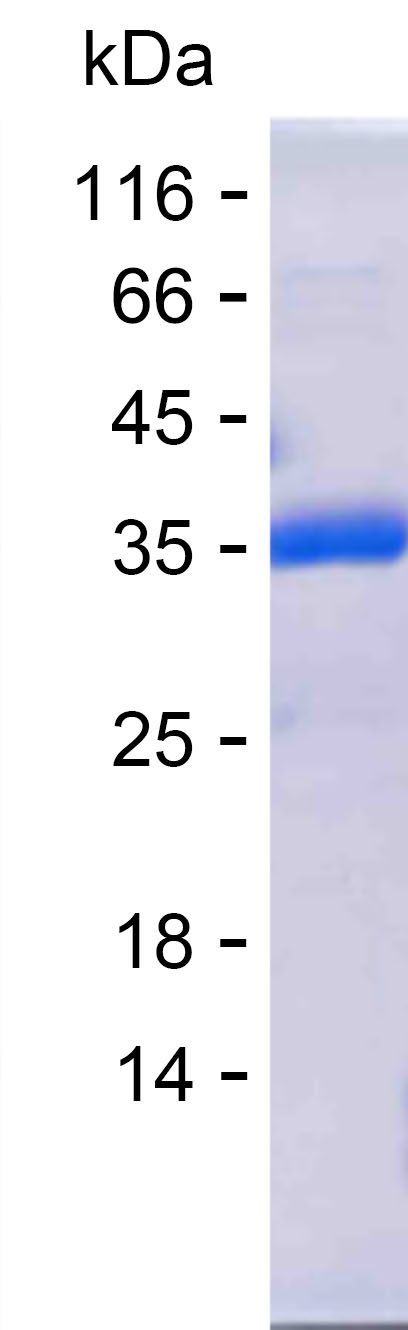 Recombinant Human NEK7 Protein(C-His)