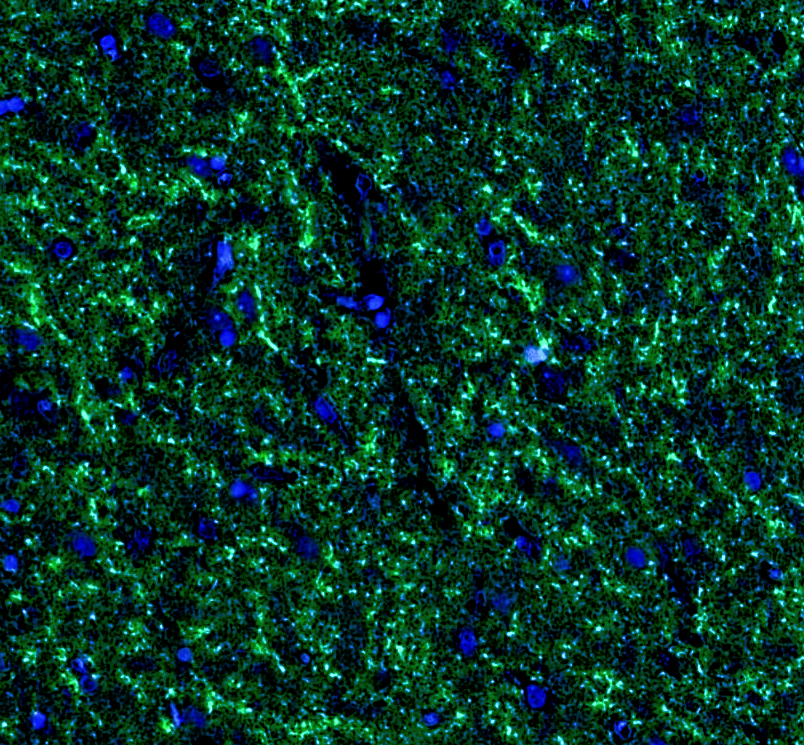 Goat anti-GAD65/GAD67 Polyclonal Antibody