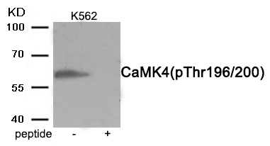 Rabbit anti-Phospho-CaMK4 (Thr196/200)Polyclonal Antibody