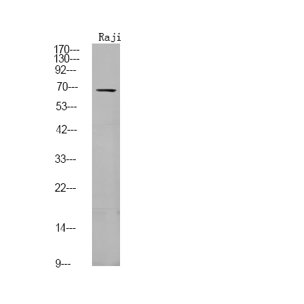 Rabbit anti-Phospho-FGR (Tyr412)Polyclonal Antibody