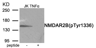 Rabbit anti-Phospho-NMDAR2B (Tyr1336)Polyclonal Antibody